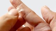 ترفندهای پاک کردن چسب قطره ای از روی پوست