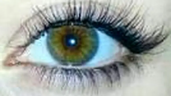 درد پشت چشم خبر از چه بیماری هایی می دهد؟