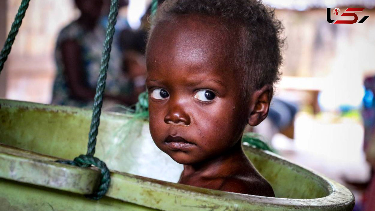 سوء تغذیه کودک آفریقایی+عکس
