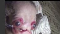تولد عجیب یک نوزاد فضایی در کره زمین +فیلم و عکس( 16+)