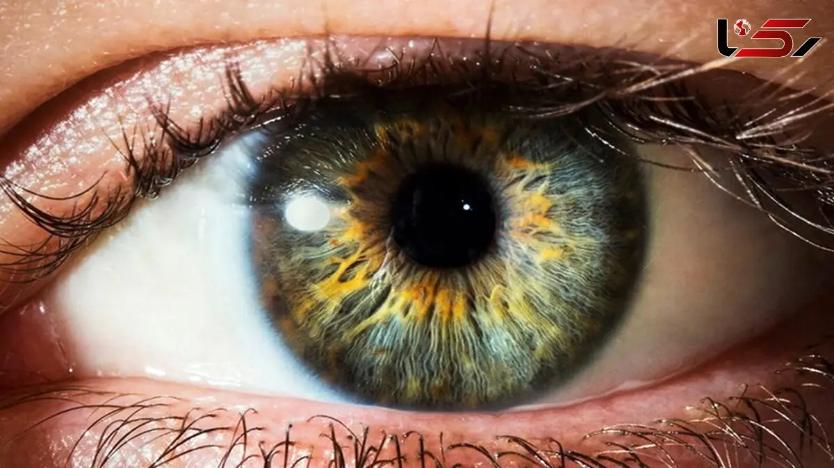 اختراع شبکه مصنوعی با کاربرد فراتر از بینایی