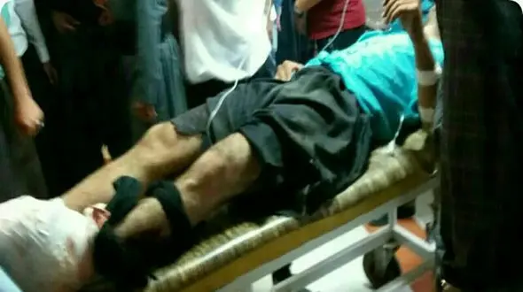 پای کارگر راه‌آهن یزد زیر قطار جا ماند+ عکس
