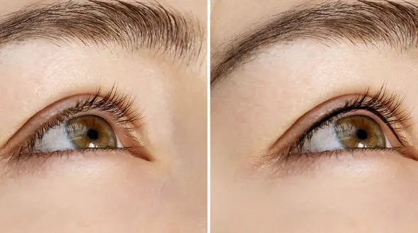 بن مژه چیست؟