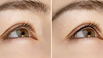 بن مژه چیست؟