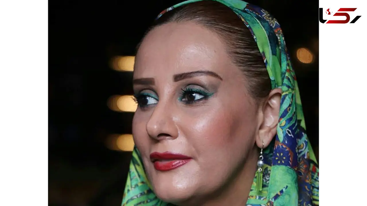 20 سال جوانتر شدن خانم بازیگر در 51 سالگی! + عکس بعد عمل زیبایی شیوا خسرومهر !