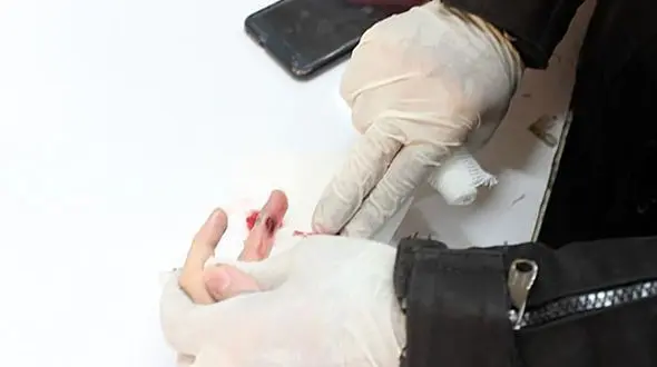  دست زن تهرانی در دستگاه دکمه‌زنی قفل شد + تصاویر 