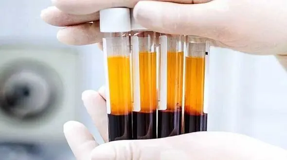 سازمان انتقال خون: مردم برای درمان بیماران کرونا پلاسما اهدا کنند