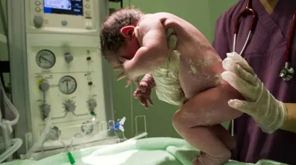 اتفاقی عجیب در اتاق زایمان؛ زنی که عکسش وایرال شد