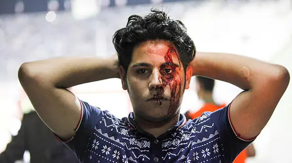 آخرین خبر از قمه کشی 2 تیم فوتبال در تبریز و مرند / کسی کور نشد + فیلم