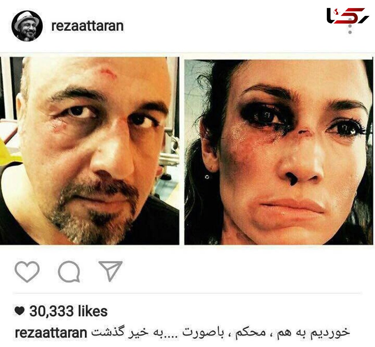 کبودی چشمان رضا عطاران با جنیفر لوپز در یک بخورد! +عکس 