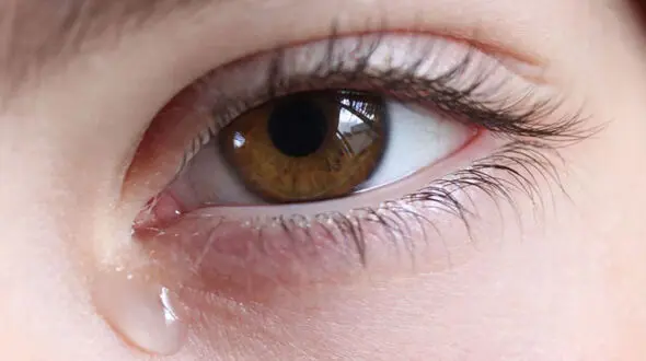 انسداد مجاری اشکی چه علائمی دارد؟ 