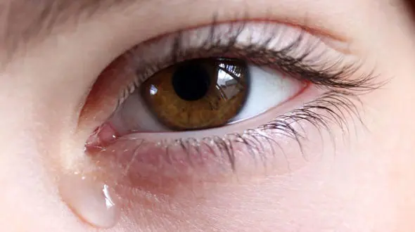 انسداد مجاری اشکی چه علائمی دارد؟ 