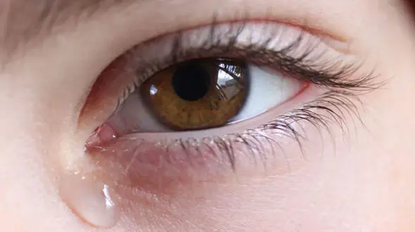 انسداد مجاری اشکی چه علائمی دارد؟ 