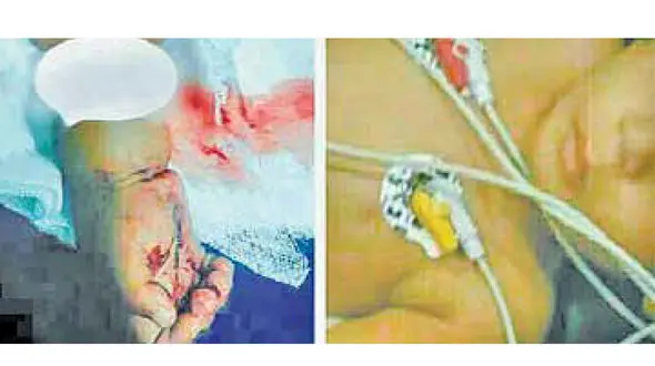 جزییات شکنجه یک کودک در خانه روستایی+عکس 