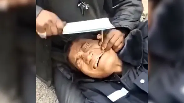 فیلم صحنه دردناک کشیدن دندان با ساتور